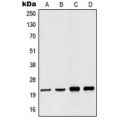 LifeSab™ NDUFB10 Rabbit pAb (50 µl)