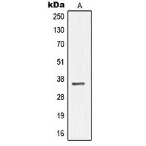 LifeSab™ NKX3-1 Rabbit pAb (50 µl)