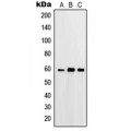 LifeSab™ Beta-glucosidase 2 Rabbit pAb (50 µl)