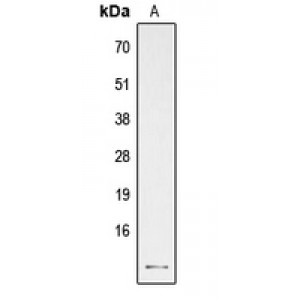 LifeSab™ PTH Rabbit pAb (50 µl)