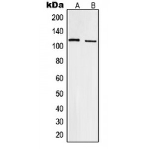 LifeSab™ Focal Adhesion Kinase (pY861) Rabbit pAb (50 µl)