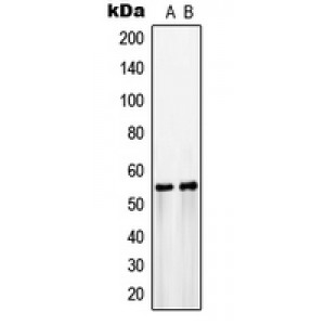 LifeSab™ GLUT3 Rabbit pAb (50 µl)