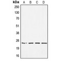 LifeSab™ SSX-pan Rabbit pAb (50 µl)