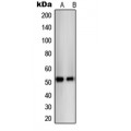 LifeSab™ THRB Rabbit pAb (50 µl)