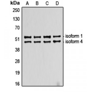 LifeSab™ p53 Rabbit pAb (50 µl)