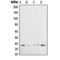 LifeSab™ XRCC3 Rabbit pAb (50 µl)