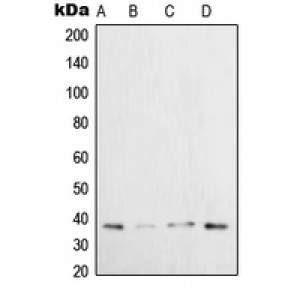 LifeSab™ XRCC3 Rabbit pAb (50 µl)