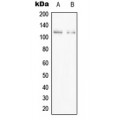 LifeSab™ PPFIBP1 Rabbit pAb (50 µl)