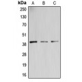 LifeSab™ B3GALT4 Rabbit pAb (50 µl)