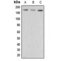 LifeSab™ MRP3 Rabbit pAb (50 µl)