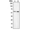 LifeSab™ CHST2 Rabbit pAb (50 µl)