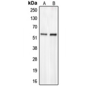 LifeSab™ CHST2 Rabbit pAb (50 µl)