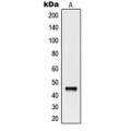 LifeSab™ CD335 Rabbit pAb (50 µl)