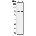 LifeSab™ Nephrocystin 5 Rabbit pAb (50 µl)