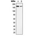 LifeSab™ LMTK2 Rabbit pAb (50 µl)