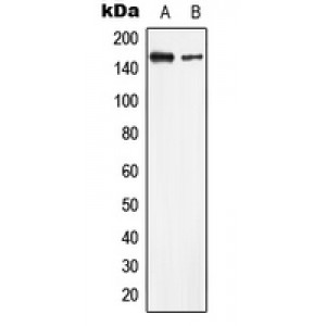 LifeSab™ LMTK2 Rabbit pAb (50 µl)