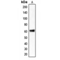 LifeSab™ CLCC1 Rabbit pAb (50 µl)