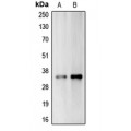 LifeSab™ Carbonic Anhydrase 14 Rabbit pAb (50 µl)