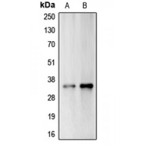 LifeSab™ Carbonic Anhydrase 14 Rabbit pAb (50 µl)