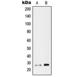 LifeSab™ RAB26 Rabbit pAb (50 µl)