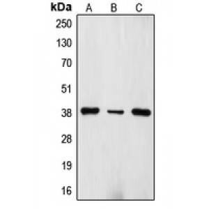 LifeSab™ TRBC1 Rabbit pAb (50 µl)