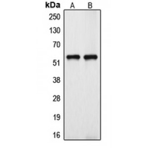 LifeSab™ Cytochrome P450 39A1 Rabbit pAb (50 µl)