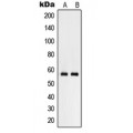 LifeSab™ RHCG Rabbit pAb (50 µl)