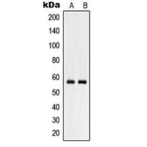 LifeSab™ RHCG Rabbit pAb (50 µl)