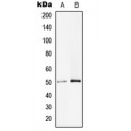 LifeSab™ PPP4R1L Rabbit pAb (50 µl)