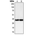 LifeSab™ NBPF-pan Rabbit pAb (50 µl)