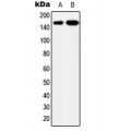 LifeSab™ YEATS2 Rabbit pAb (50 µl)