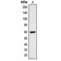 LifeSab™ DCLRE1B Rabbit pAb (50 µl)