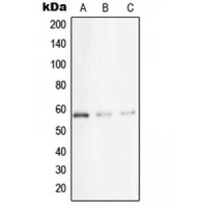 LifeSab™ STK33 Rabbit pAb (50 µl)