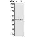 LifeSab™ Apolipoprotein L6 Rabbit pAb (50 µl)