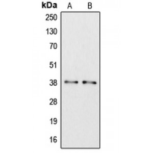 LifeSab™ Apolipoprotein L6 Rabbit pAb (50 µl)