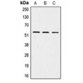 LifeSab™ LRP11 Rabbit pAb (50 µl)