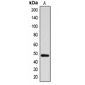 LifeSab™ ARRDC1 Rabbit pAb (50 µl)