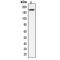 LifeSab™ ABCC12 Rabbit pAb (50 µl)