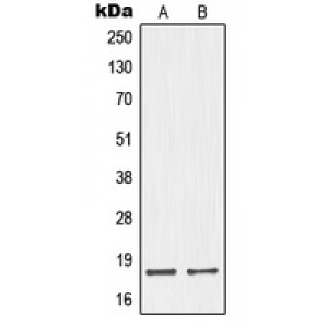 LifeSab™ Neuromedin S Rabbit pAb (50 µl)