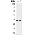 LifeSab™ RNF113B Rabbit pAb (50 µl)