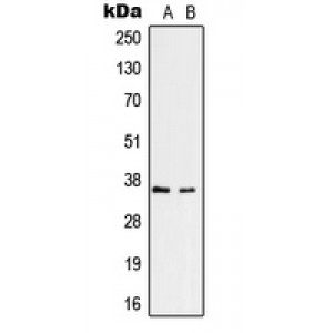 LifeSab™ RNF113B Rabbit pAb (50 µl)