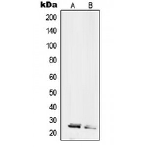 LifeSab™ RPL10L Rabbit pAb (50 µl)