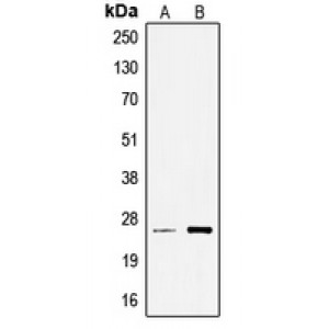 LifeSab™ TCEAL6 Rabbit pAb (50 µl)