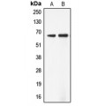 LifeSab™ ADCK5 Rabbit pAb (50 µl)