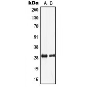 LifeSab™ LDLRAD2 Rabbit pAb (50 µl)