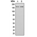 LifeSab™ SGK223 (pY413) Rabbit pAb (50 µl)