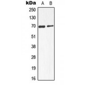 LifeSab™ Alpha-fetoglobulin Rabbit pAb (50 µl)