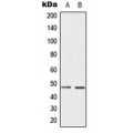 LifeSab™ Cyclin E1 (pT395) Rabbit pAb (50 µl)