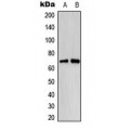 LifeSab™ Estrogen Receptor alpha (pS118) Rabbit pAb (50 µl)