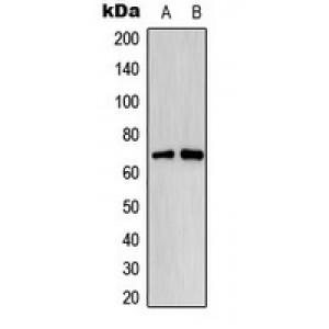 LifeSab™ Estrogen Receptor alpha (pS118) Rabbit pAb (50 µl)